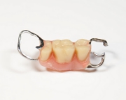金属バネ付き入れ歯の写真