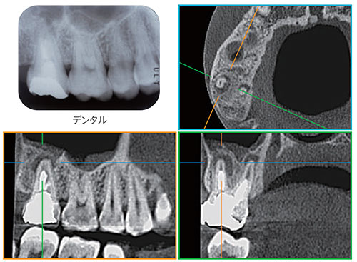 歯科用CTの写真