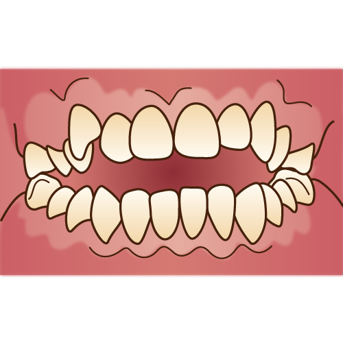 歯並びを治したい方 矯正歯科 浦安市の歯医者 わかば歯科クリニック
