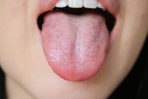 舌の写真